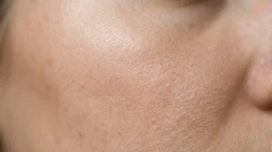 Primo piano dettagliato di pelle del viso con texture affinata e pori minimizzati sotto luce naturale morbida