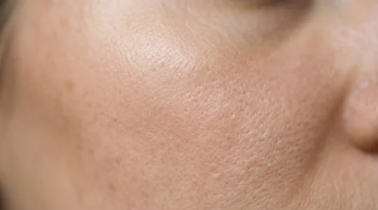 Primo piano dettagliato di pelle del viso con texture affinata e pori minimizzati sotto luce naturale morbida